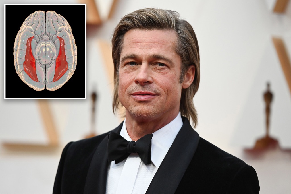 What is prosopagnosia? All about Brad Pitt's face blindness condition ...