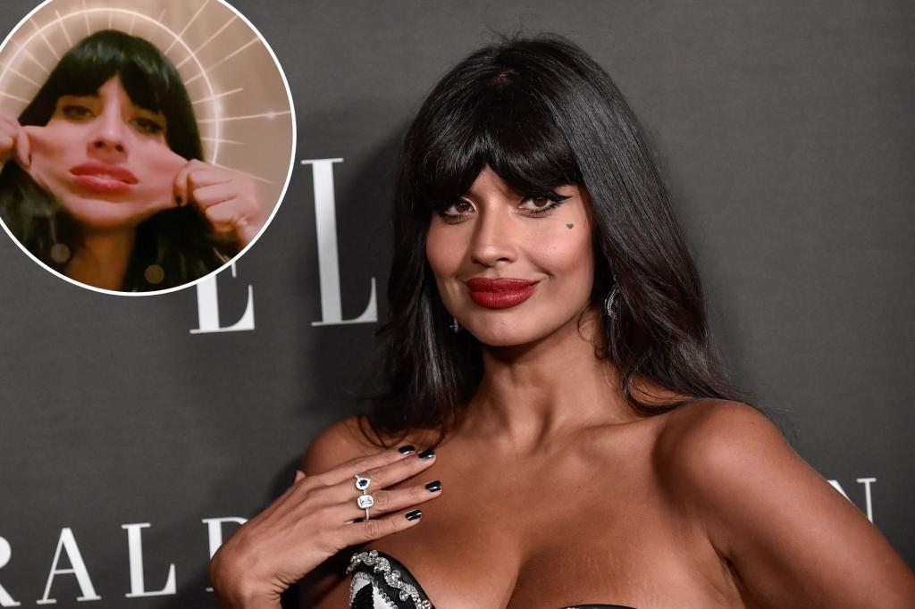 Jameela Jamil reveals rare tissue disorder battle, says haters made her